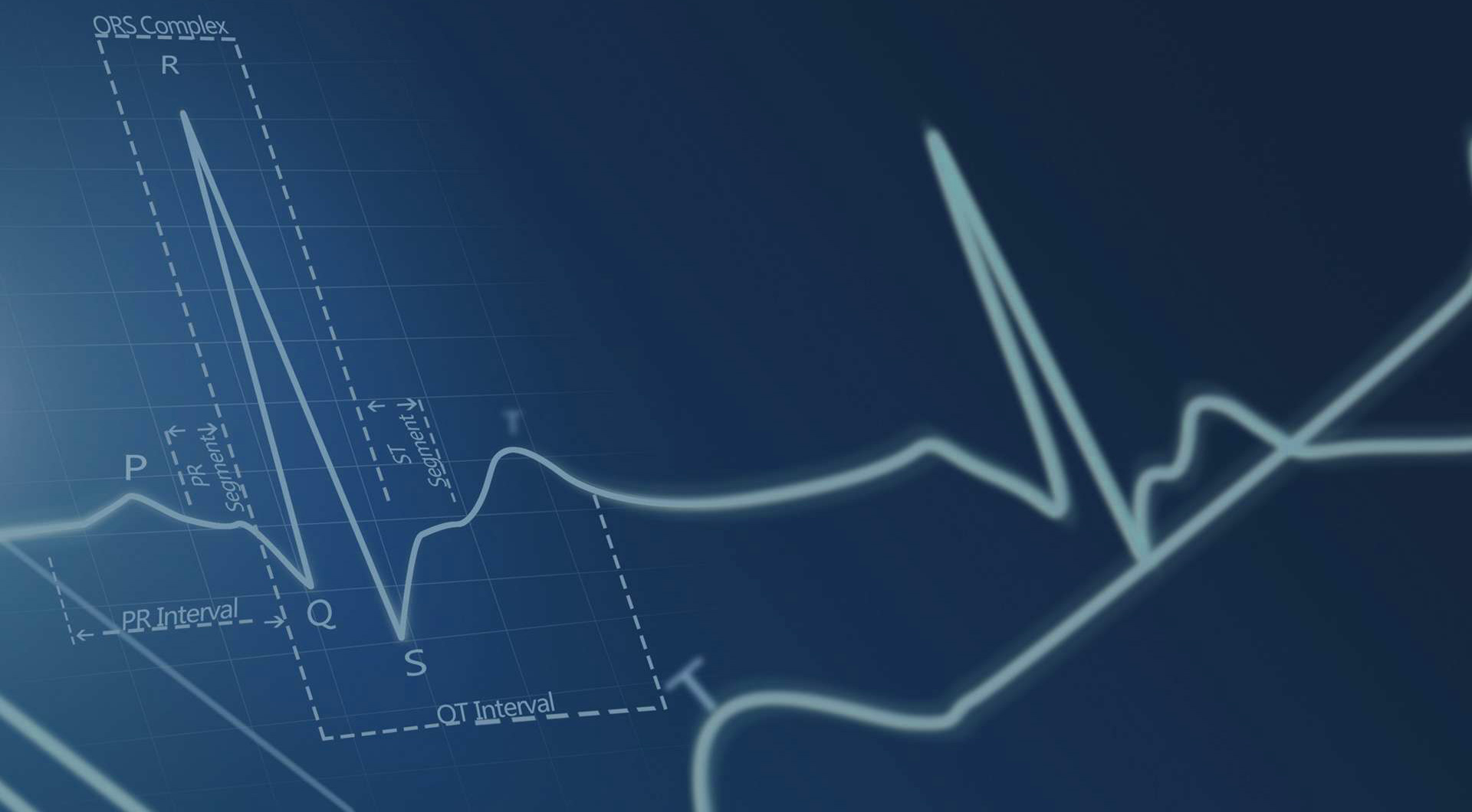 噪聲振動(dòng)檢測(cè)